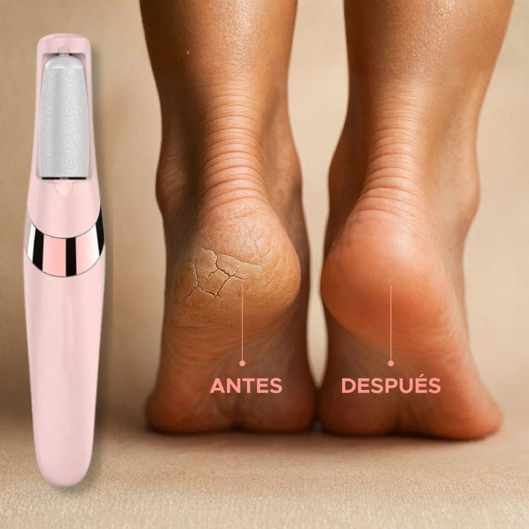 Removedor de Callos + Rodillo y Cepillo de Regalo